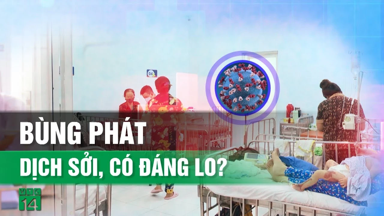 Dịch sởi bùng phát, cha mẹ cần lưu ý những gì?